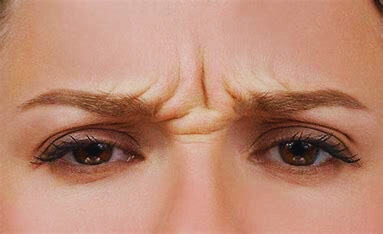 What Are Furrowed Brows?How To Prevent And Reduce Furrowed Brows?