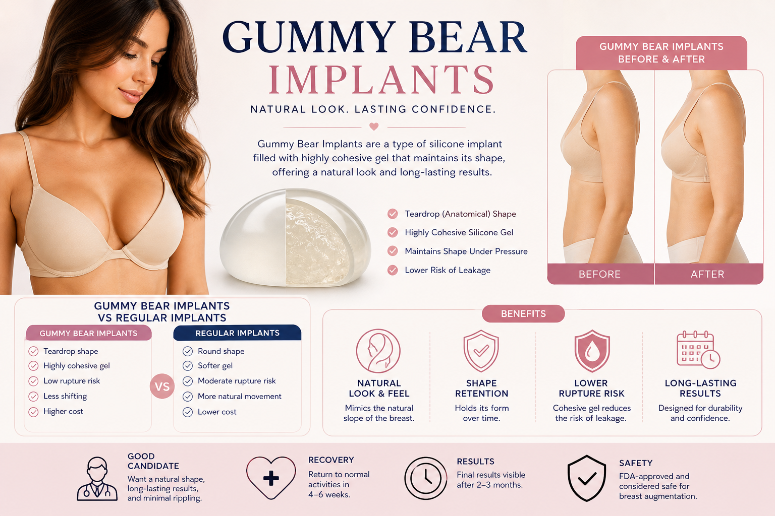 Gummy Bear Implants: Everything You Need to Know